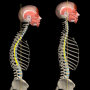 icon Kyphosis(Kyphosis Rounded Back by Muscle and Motion
)