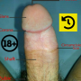 icon Penis Anatomy(Anatomi Penis
)
