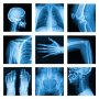 icon Medical X-Ray Interpretation(Interpretasi Sinar-X Medis UV dengan 100+ Kasus
)