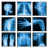 icon Medical X-Ray Interpretation(Interpretasi Sinar-X Medis UV dengan 100+ Kasus
) 4.0.2