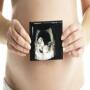 icon Ultrasound pregnancy guide()